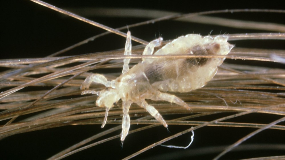 What head lice can tell us about human migration